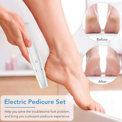 🔥Hot Sale - 50% OFF🔥Electric Feet Callus Remover?