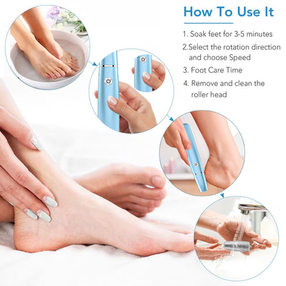 🔥Hot Sale - 50% OFF🔥Electric Feet Callus Remover?