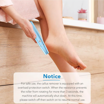 🔥Hot Sale - 50% OFF🔥Electric Feet Callus Remover?