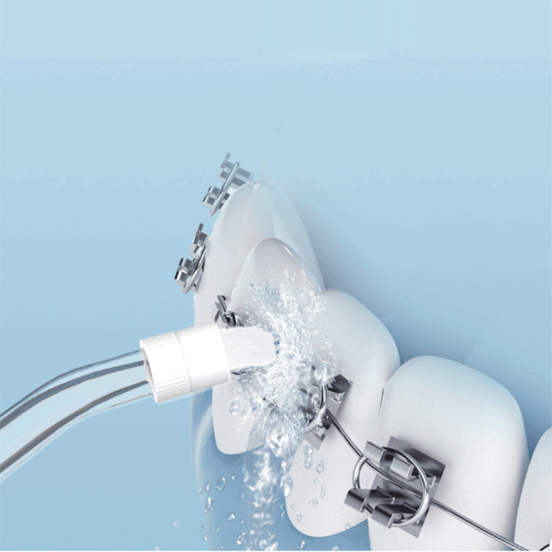 💝50% OFF|Portable Water Flosser