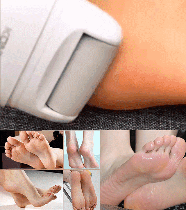 Rechargeable electric foot callus remover