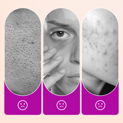 💝Buy 1 Get 1 Free🔥Flawless Brightening Under Eye Concealer